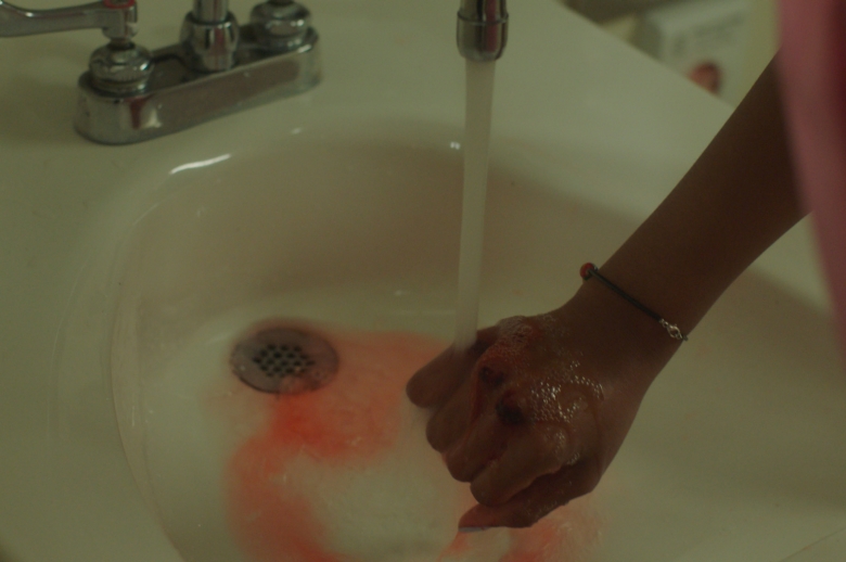 bloody knuckles being rinsed under a sink