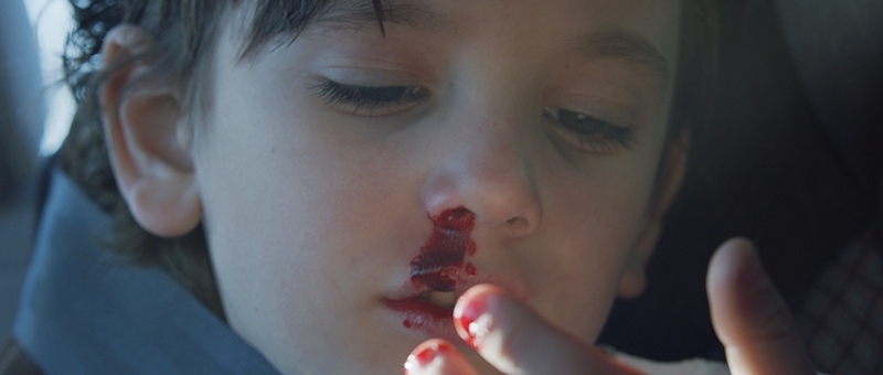 A closeup image of a young boy with a bleeding nose.