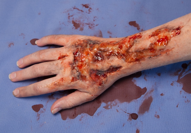 Image of a hand bleeding, with deep cuts and scrapes, created with SFX make-up.